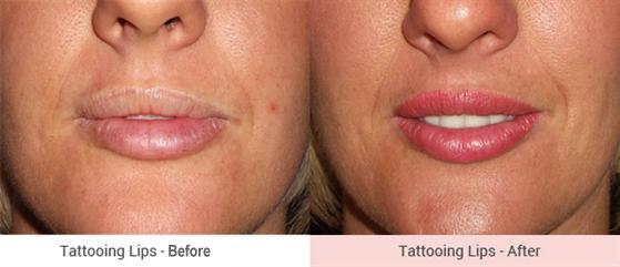 Cosmetic Tattoing, Eyebrow Experts