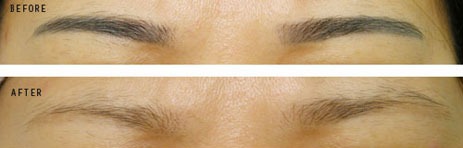 Cosmetic Tattoing, Eyebrow Experts